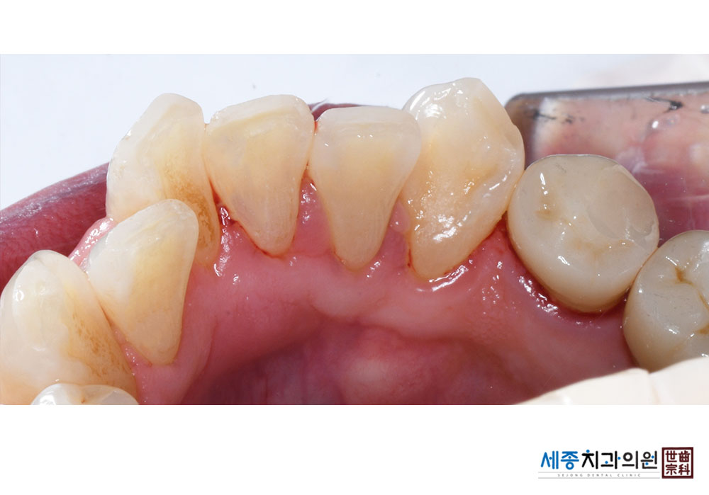 정우승_20220519_163453.jpg