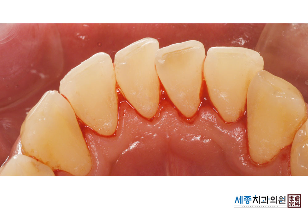 박정렬_20220824_195311.jpg
