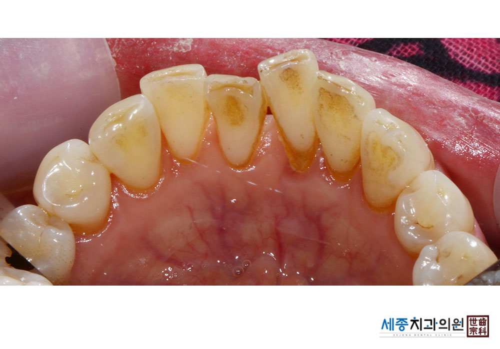 e08aadf5c684de70dc21e6f2053ae230.jpg