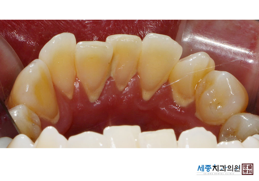 dafa4dec15b49c42ccd549c9d9b00079.jpg