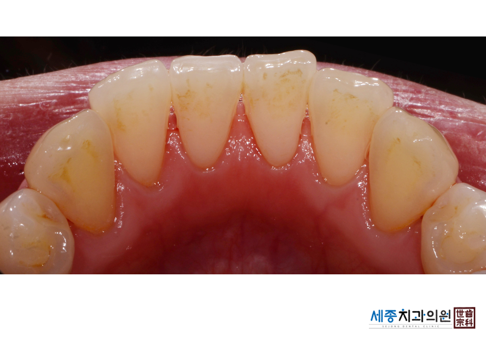 강래선(전 후기)_d15_20210304_115155769.jpg