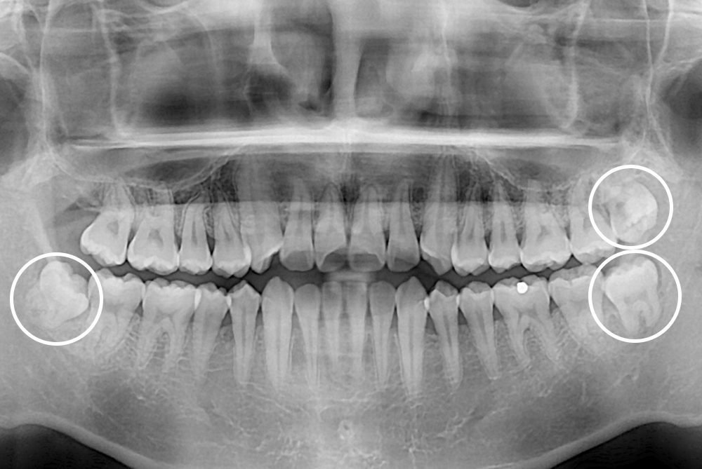 d48ab6b57de9c50e379ddf27af5f5ae1.jpg