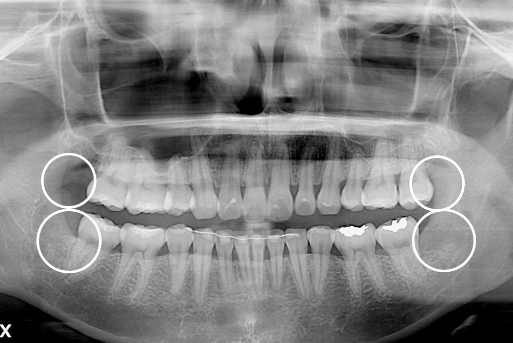 PX20200121_145039_0014_00000000.jpg