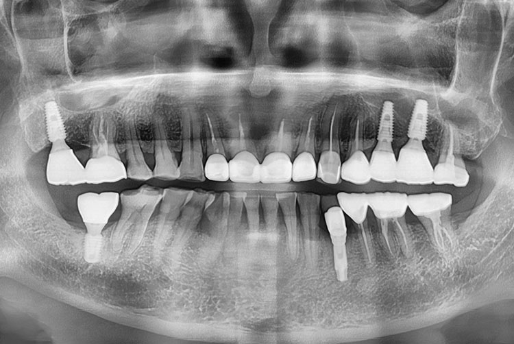 PX20220111_162552_0000_0000A73C.jpg