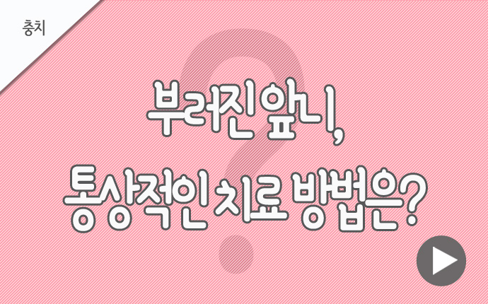 26충치 부러진 앞니.jpg