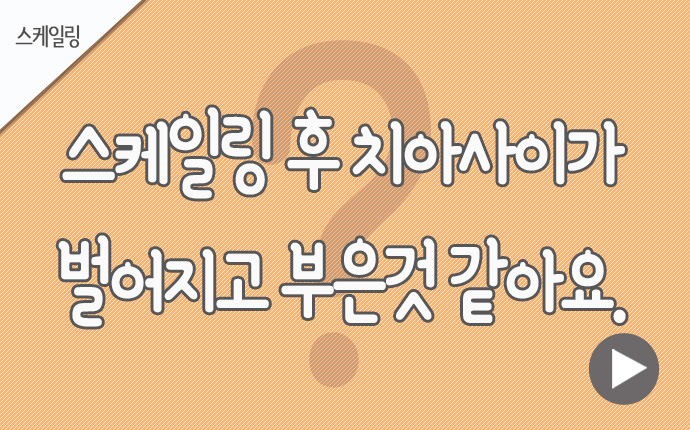 28스케일링 치아사이.jpg