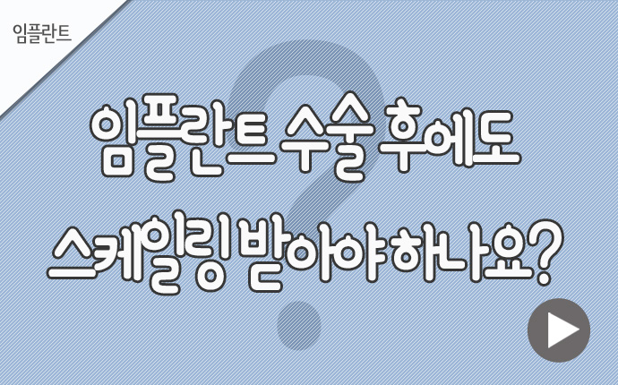 33임플란트 스케일링.jpg