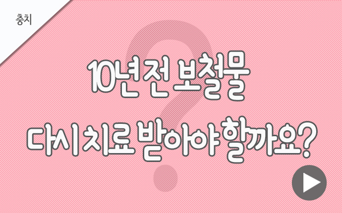 34충치 10년전 보철물.jpg