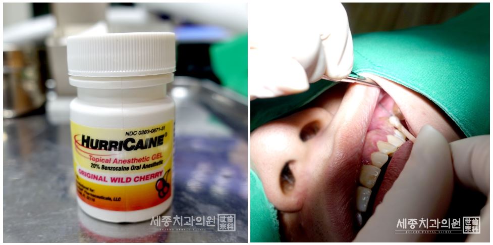 정홍민 환자분4.JPG