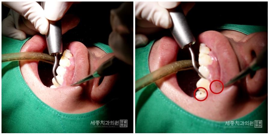 정홍민 환자분13.JPG
