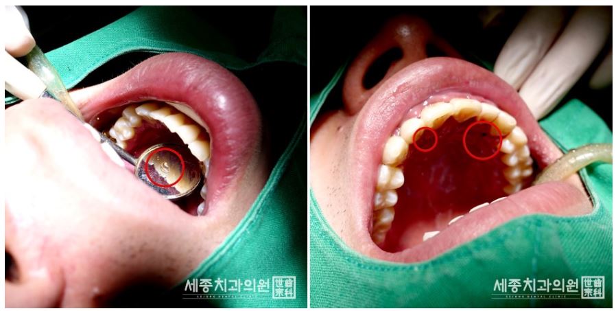 정홍민 환자분14.JPG