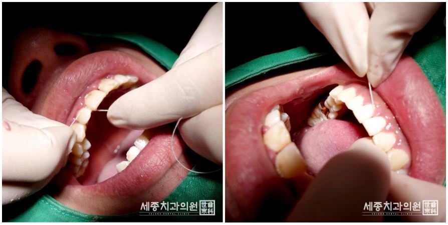 정홍민 환자분16.JPG