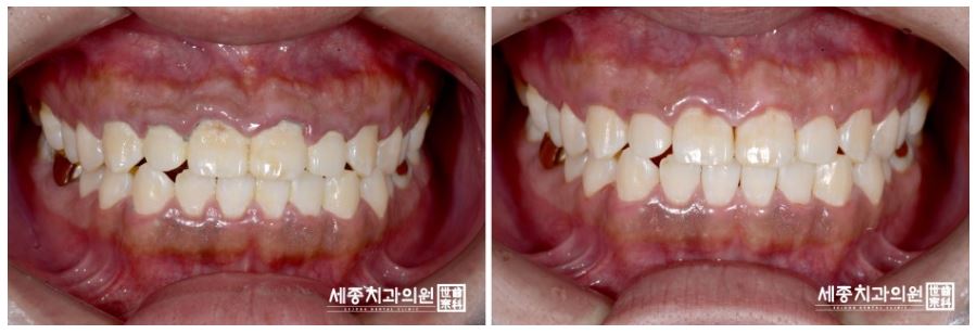 정홍민 환자분18.JPG