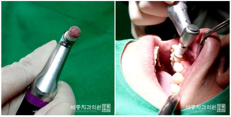 정홍민 환자분15.JPG